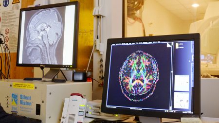 Brain scans are shown on two comptuer screens.